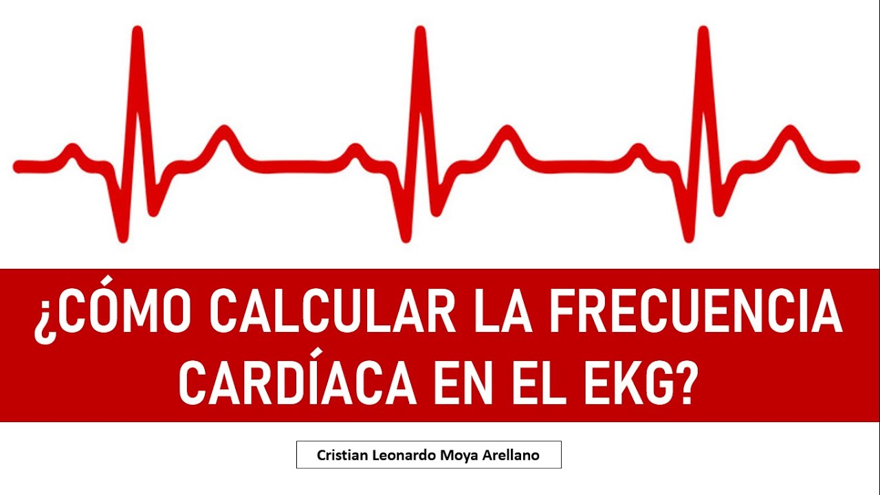 🔴 ¿Cómo Calcular La FRECUENCIA CARDÍACA En El ELECTROCARDIOGRAMA ...