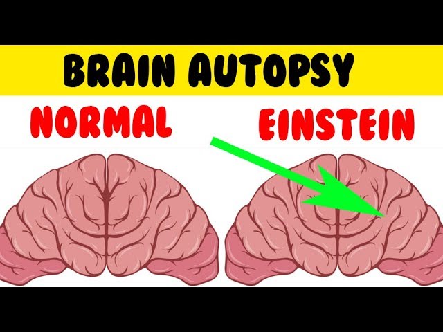 Einstein Brain Vs Normal Brain