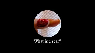 What is a scar? #shorts