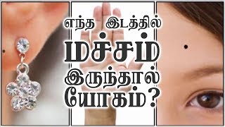 9443165504 - எந்த இடத்தில் மச்சம் இருந்தால் யோகம்!