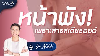 หน้าพังเพราะสารสเตียรอยด์