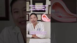 Yes, you can still conceive with uterine polyps!