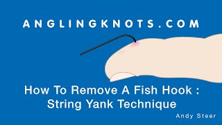 How To Remove A Fish Hook : String Yank Technique