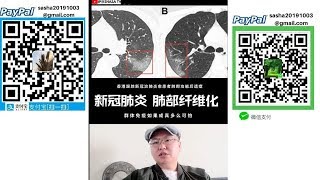 新冠肺炎后遗症 肺部纤维化 肺功能损伤 群体免疫如果成真多么可怕