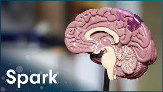 What Happens To The Brain In Old Age? | The Brain Fitness Program | Spark