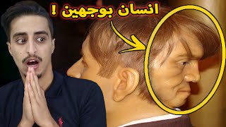 هذا الرجل عاش بوجهين في جسد واحد !! وجه الشيطان 😨