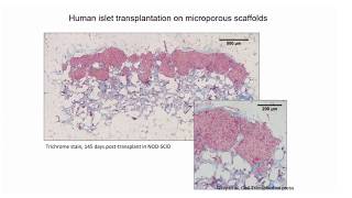 Local and Systemic Immunomodulation for Regenerative Medicine