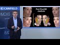 dr. tiago baptista fernades on vectra® 3d imaging