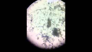 1 Dust mites (噁心的活塵螨)