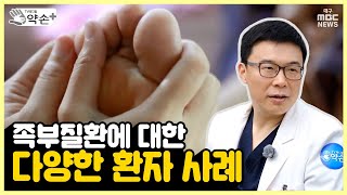 족부질환에 대한 다양한 환자 사례 [족부질환의 진단과 치료 ⑰] | 메디컬 약손