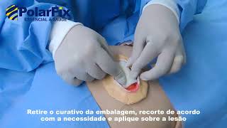 Aplicação Wound Care A - Curativo de Alginato de Cálcio Estéril - Polar Fix