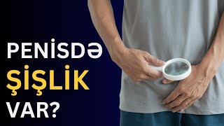 CİNSİ ORQANDA ŞİŞ, AĞRI...Balanopostit nədir? | Azər Mirzəyev