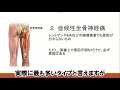 坐骨神経痛が再発するたった１つの理由と悪化を防ぐ対処法【市川市腰痛専門整体院】