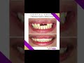 dr.nessanicolas |Smile Transformation 🦷 - Dental Surgeon Hub