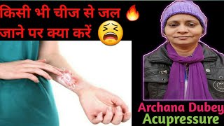 Burn injuries (किसी भी चीज से जल जाने पर क्या करें) हिंदी में