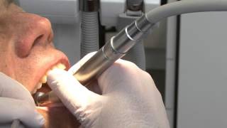 Dental drill