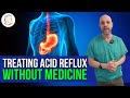 How To Treat Acid Reflux (GERD) without Medicine (Omeprazole)