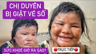 Trực Tiếp | Chị Duyên kể lại sự việc bị giật vé số, bụng to đùng không biết bệnh gì mà bác sĩ chạy?