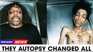 10 Shocking Autopsy Revelations From R&B Legends’ Deaths