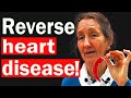 Dr Barbara O'Neill Reveals 5 Shocking Foods To REVERSE HEART DISEASE.