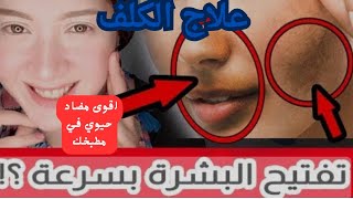 أقوي ماسك هيرجع بشرتك أصغر بعشر سنوات 💪 مرمى في مطبخك اقوى بوتكس طبيعي