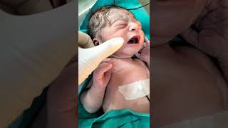 Loudly crying after birth new born baby #viralbaby #trandingshorts #viralvideo