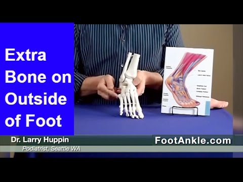 What is the bone that sticks out on the side of your ankle?