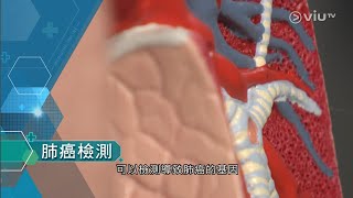 【杏林在線 💊➕ Medicine Online】《〖腎〗防高血糖⚕️（糖尿腎）/肺🫁癌檢測》〖何子澄〗 2023年12月15日