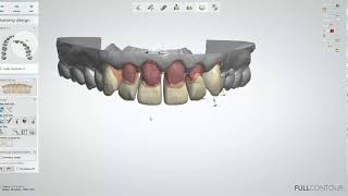 3shape smile library