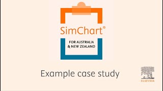 SimChart - An example case study