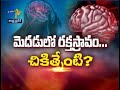 About Hemorrhagic bleeding | Sukhibhava | 13th October 2021 | ETV Andhra Pradesh