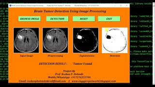 Python Code On Brain Tumor Detection Using Image Processing full Source Code | IEEE Based Projects