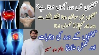 Ghotno ka Dard Q hota Ha?گھٹنوں کا درد کیوں ہوتا ہے|| ||وجوہات اور مکمل علاجDr.Abid hussain#kneepain