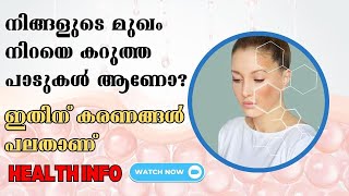 നിങ്ങളുടെ മുഖം നിറയെ കറുത്ത പാടുകൾ ആണോ ? #skincare #darkcircles