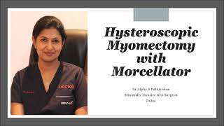 Hysteroscopic Myomectomy with Morcellator , Dr Alphy S Puthiyidom ,Dubai