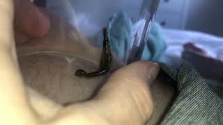 Tiger leech bloodletting my thigh