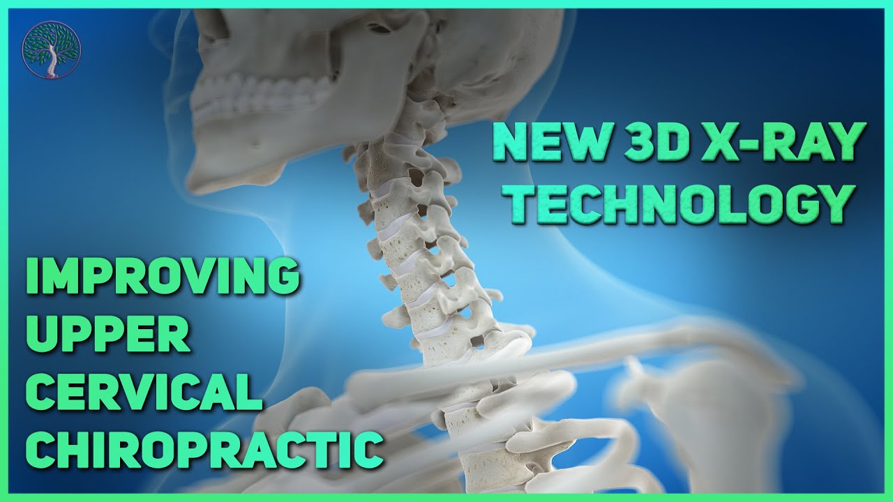 Improving Upper Cervical Chiropractic With 3D Imaging - YouTube