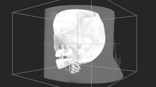 2D Texture Based-Volume Rendering