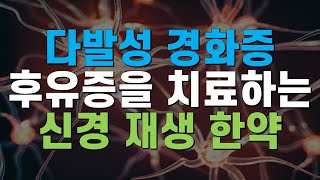 다발 경화증, 다발성 경화증 후유증을 치료하는 신경 재생 한약