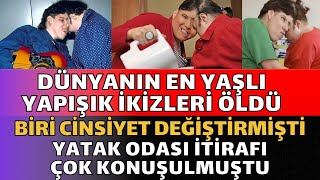 Dünyanın En Yaşlı Yapışık İkizleri 62 Yaşında Öldü | 30 Yıl Yaşar Demişlerdi