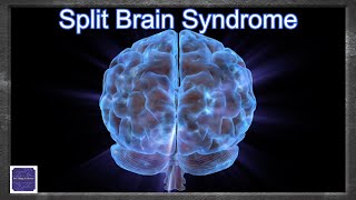 Split Brain Syndrome