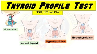 Thyroid Profile/Function Test Interpretation: TSH, Free T4 and Free T3 - UNDERSTAND with Examples