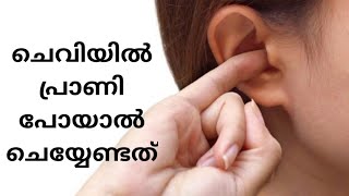 ചെവിയിൽ പ്രാണി പോയാൽ ചെയ്യേണ്ടത്( First Aid )