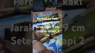 Perbaikan kaki leter O