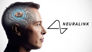 Elon Musk's Neuralink 'brain chips' cleared for 1st in-human trials