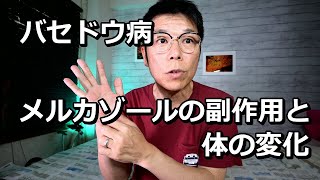 バセドウ病 メルカゾールの副作用 体の変化は？