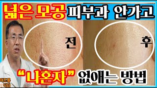 모공 줄이는법  (셀프케어 비밀노하우)  전격공개합니다!!!