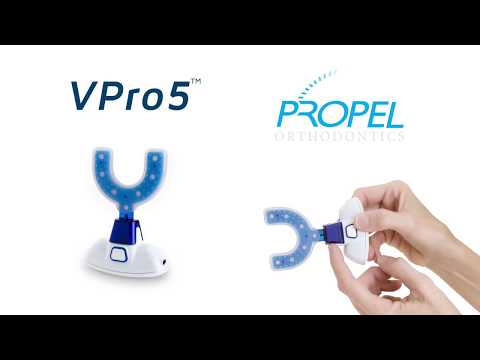 Propel VPro5 For Invisalign - How It Works! Propel VPro5 For Invisalign - How It Works!