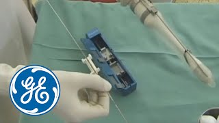 Tru-Cut Biopsy in Gynecologic Oncology | GE Healthcare