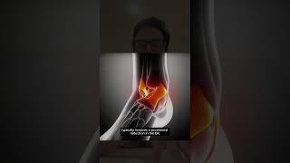 Ortho Surgeon Breakdown: Cam Skattebo’s Ankle Fracture Dislocation